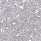 Anti-TRMT2B Antibody