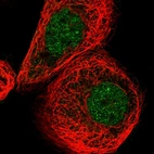 Immunofluorescent staining of human cell line A-431 shows localization to nucleoplasm.