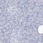 Immunohistochemical staining of human pancreas shows no positivity in exocrine glandular cells as expected.