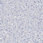 Immunohistochemical staining of human liver shows no positivity in hepatocytes as expected.