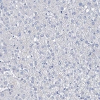 Immunohistochemical staining of human liver shows no positivity in hepatocytes as expected.