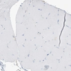 Immunohistochemical staining of human skeletal muscle shows no positivity in myocytes as expected.