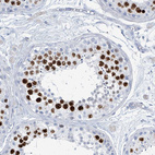 Immunohistochemical staining of human testis shows strong nuclear positivity in cells in seminiferous ducts.
