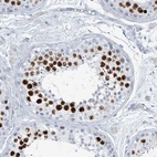 Immunohistochemical staining of human testis shows strong nuclear positivity in cells in seminiferous ducts.