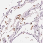 Immunohistochemical staining of human lung shows strong membranous positivity in macrophages.