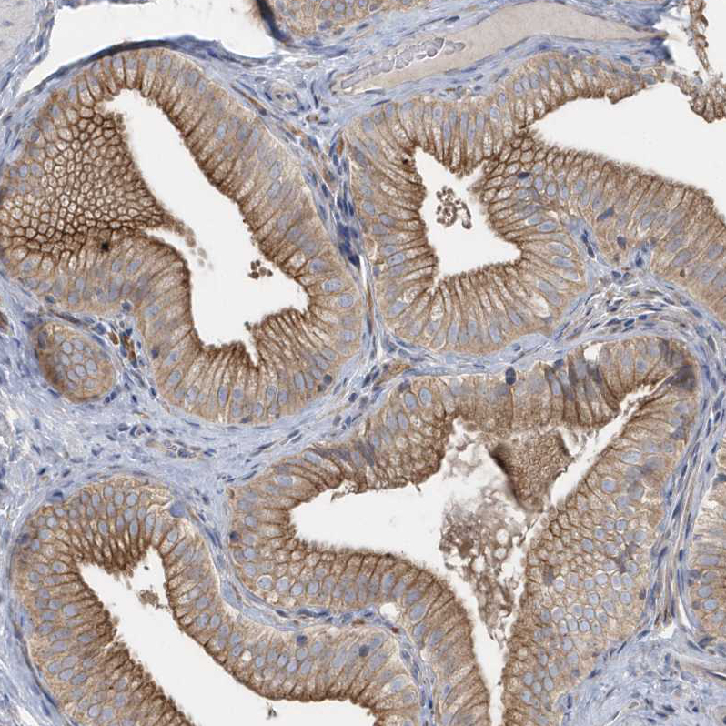 Anti-RAB17 Antibody