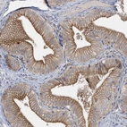 Anti-RAB17 Antibody