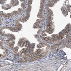 Immunohistochemical staining of human fallopian tube shows moderate membranous positivity in glandular cells.