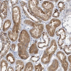 Immunohistochemical staining of human kidney shows moderate granular cytoplasmic positivity in cells in tubules.