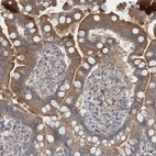 Immunohistochemical staining of human small intestine shows moderate granular cytoplasmic positivity in glandular cells.