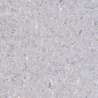 Immunohistochemical staining of human cerebral cortex shows no positivity in neurons as expected.