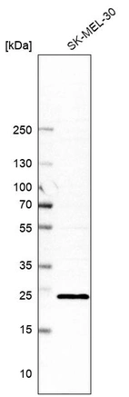 Western blot analysis in human cell line SK-MEL-30.