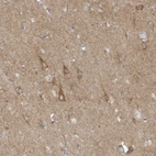 Immunohistochemical staining of human cerebral cortex shows moderate cytoplasmic positivity in neurons.