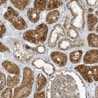 Immunohistochemical staining of human kidney shows moderate 
 cytoplasmic positivity in cells in tubules.