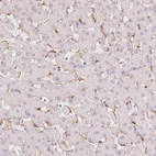 Immunohistochemical staining of human liver shows moderate positivity in Kupffer cells.