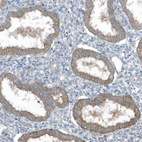 Anti-SLC38A2 Antibody