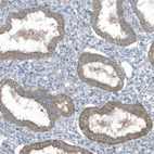 Immunohistochemical staining of human endometrium shows moderate cytoplasmic positivity in glandular cells.