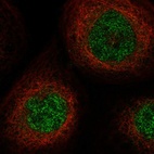 Immunofluorescent staining of human cell line A-431 shows localization to nucleoplasm.