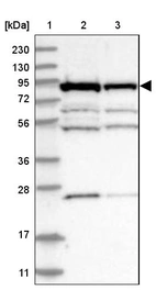 Lane 1: Marker [kDa] 230, 130, 95, 72, 56, 36, 28, 17, 11_br/_Lane 2: Human cell line RT-4_br/_Lane 3: Human cell line U-251MG sp