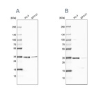 Western blot analysis using Anti-DNAJC9 antibody HPA035216 (A) shows similar pattern to independent antibody HPA035215 (B).