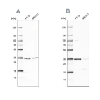 Western blot analysis using Anti-DNAJC9 antibody HPA035216 (A) shows similar pattern to independent antibody HPA035215 (B).