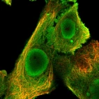 Immunofluorescent staining of human cell line PC-3 shows localization to nucleoplasm, plasma membrane & cytosol.