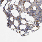 Anti-PEAR1 Antibody