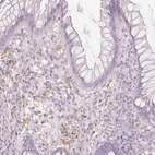 Immunohistochemical staining of human rectum shows moderate positivity in lymphoid cells.
