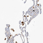 Immunohistochemical staining of human lung shows moderate membranous positivity in macrophages.