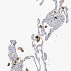 Immunohistochemical staining of human lung shows moderate membranous positivity in macrophages.