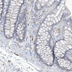 Immunohistochemical staining of human colon shows no membranous positivity in glandular cells as expected.