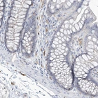 Immunohistochemical staining of human colon shows no membranous positivity in glandular cells as expected.