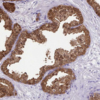 Immunohistochemical staining of human prostate shows strong positivity in glandular cells.