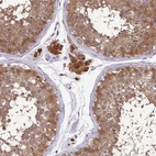 Immunohistochemical staining of human testis shows strong cytoplasmic positivity in cells in seminiferous ducts and i Leydig cells.