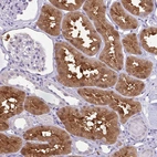Immunohistochemical staining of human kidney shows moderate positivity in cells in tubules.