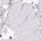 Anti-IDH1 Antibody