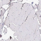 Immunohistochemical staining of human skeletal muscle shows no positivity in myocytes as expected.