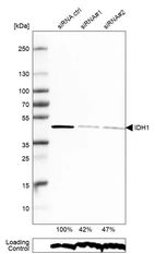 Western blot analysis in RT-4 cells transfected with control siRNA, target specific siRNA probe #1 and #2, using Anti-IDH1 antibody. Remaining relative intensity is presented. Loading control: Anti-PPIB.