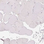 Immunohistochemical staining of human skeletal muscle shows no positivity in myocytes as expected.