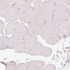 Immunohistochemical staining of human skeletal muscle shows no positivity in myocytes as expected.