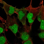 Immunofluorescent staining of human cell line AF22 shows localization to nucleus, nucleoli & plasma membrane.
