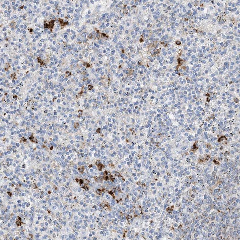 Anti-DPH3 Antibody