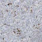 Anti-DPH3 Antibody