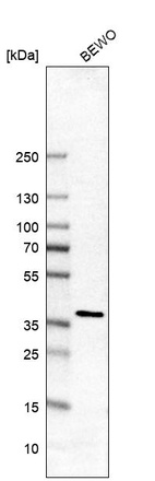 Western blot analysis in human cell line BEWO.