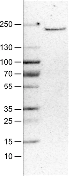 Lane 1: Marker [kDa]_br/_Lane 2: Human liver tissue lysate