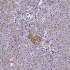 Anti-CD99 Antibody