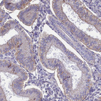 Anti-CD99 Antibody