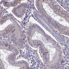 Immunohistochemical staining of human endometrium shows moderate membranous positivity in glandular cells.