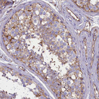 Immunohistochemical staining of human testis shows strong membranous positivity in cells in seminiferous ducts.