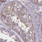 Immunohistochemical staining of human testis shows strong membranous positivity in cells in seminiferous ducts.